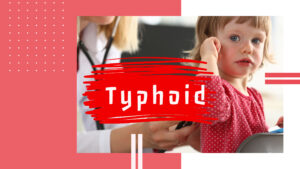 typhoid